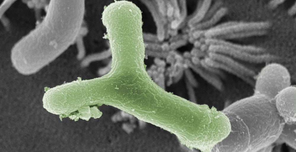 Bifidobakterienstamm B. bifidum HI-MIMBb75